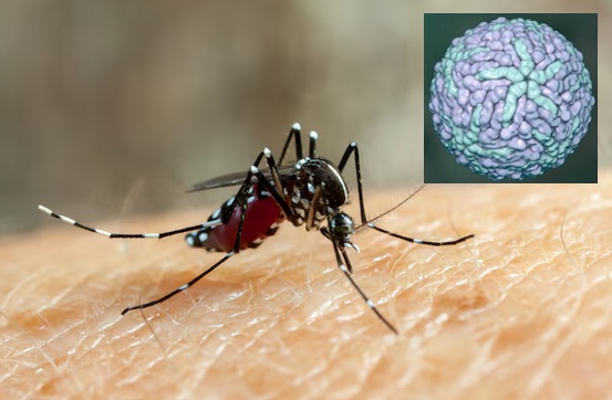 Le Chikungunya